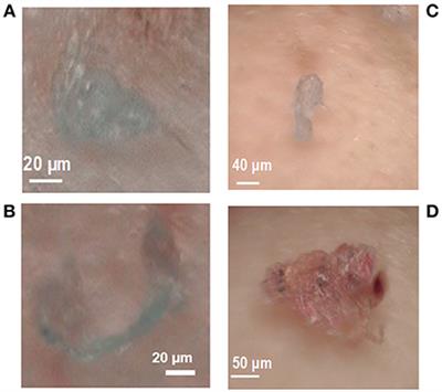 Tissue-Specific Biomarker Responses in the Blue Mussel Mytilus spp. Exposed to a Mixture of Microplastics at Environmentally Relevant Concentrations